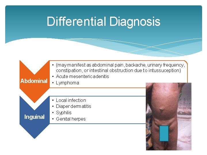 Differential Diagnosis • (may manifest as abdominal pain, backache, urinary frequency, constipation, or intestinal Differential Diagnosis • (may manifest as abdominal pain, backache, urinary frequency, constipation, or intestinal