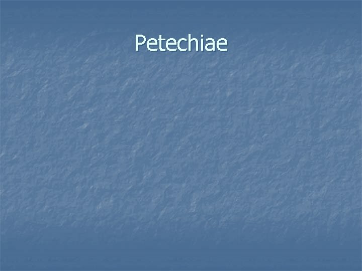 Petechiae 