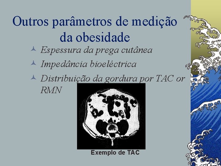 Outros parâmetros de medição da obesidade © Espessura da prega cutânea © Impedância bioeléctrica