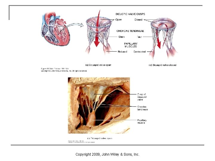 Chapter 20 The Cardiovascular System The Heart Copyright