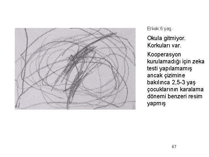 Erkek: 6 yaş. Okula gitmiyor. Korkuları var. Kooperasyon kurulamadığı için zeka testi yapılamamış ancak