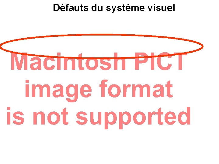 Défauts du système visuel 