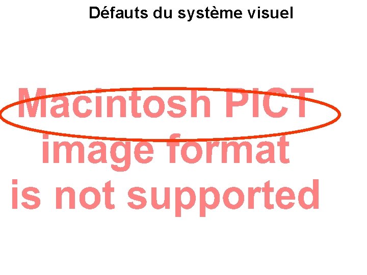 Défauts du système visuel 