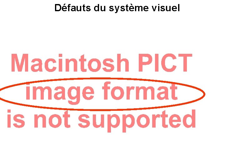Défauts du système visuel 