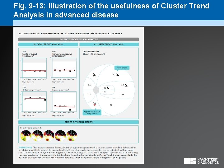 Fig. 9 -13: Illustration of the usefulness of Cluster Trend Analysis in advanced disease