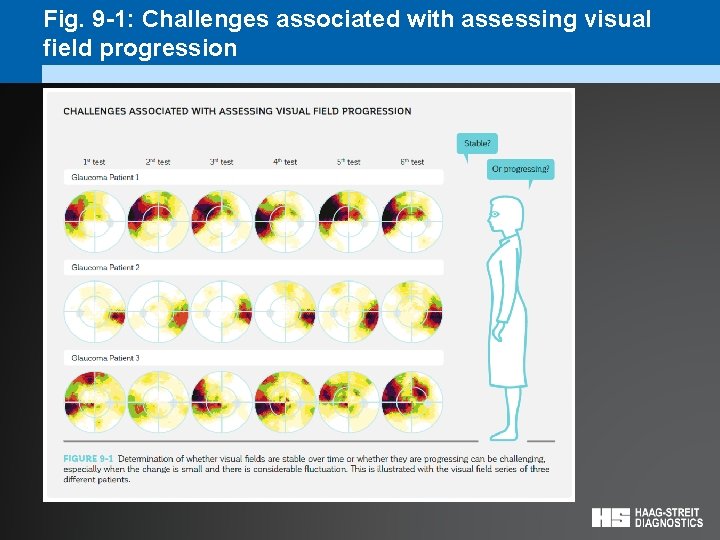Fig. 9 -1: Challenges associated with assessing visual field progression 