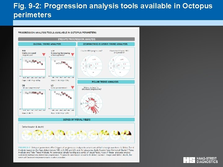 Fig. 9 -2: Progression analysis tools available in Octopus perimeters 