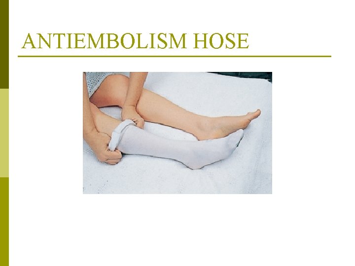 ANTIEMBOLISM HOSE From Elkin MF, Perry AG, Potter PA: Nursing interventions and clinical skills,