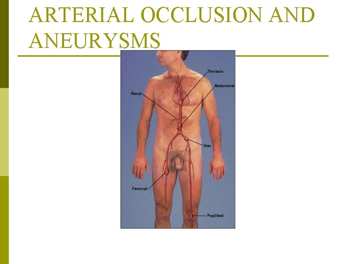 ARTERIAL OCCLUSION AND ANEURYSMS From Monahan, F. & Neighbors, M. (1998). Medical-surgical nursing: Foundations