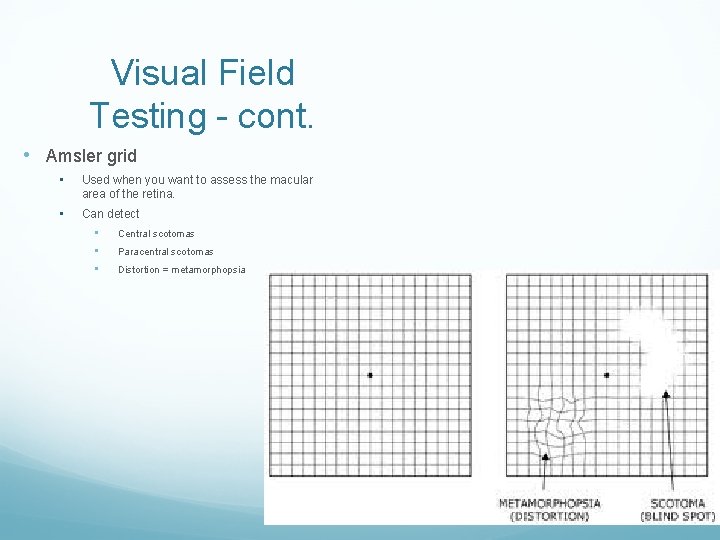 Visual Field Testing - cont. • Amsler grid • Used when you want to