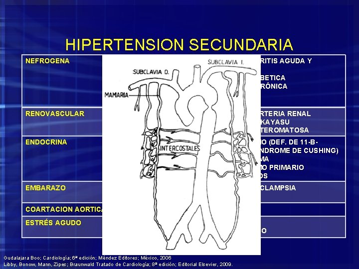 HIPERTENSION SECUNDARIA NEFROGENA 1. 2. 3. GLOMERULONEFRITIS AGUDA Y CRONICA NEFROPATIA DIABETICA PIELONEFRITIS CRÓNICA