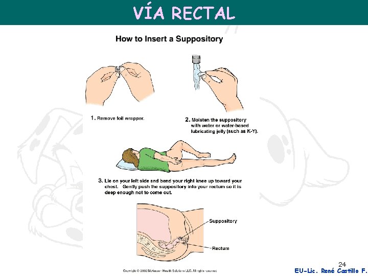 VÍA RECTAL 24 EU-Lic. René Castillo F. 