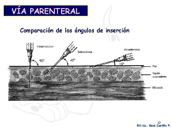 VÍA PARENTERAL Comparación de los ángulos de inserción 32 EU-Lic. René Castillo F. 