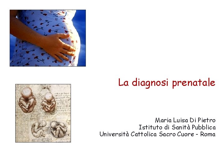 La diagnosi prenatale Maria Luisa Di Pietro Istituto di Sanità Pubblica Università Cattolica Sacro