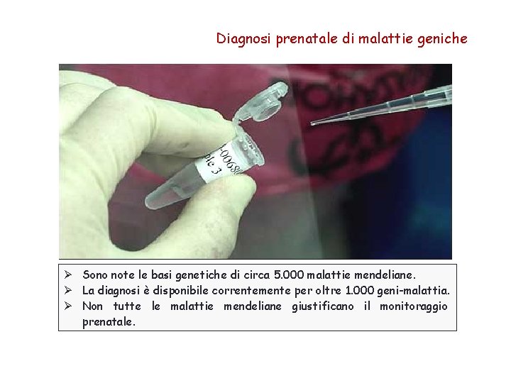 Diagnosi prenatale di malattie geniche Ø Sono note le basi genetiche di circa 5.