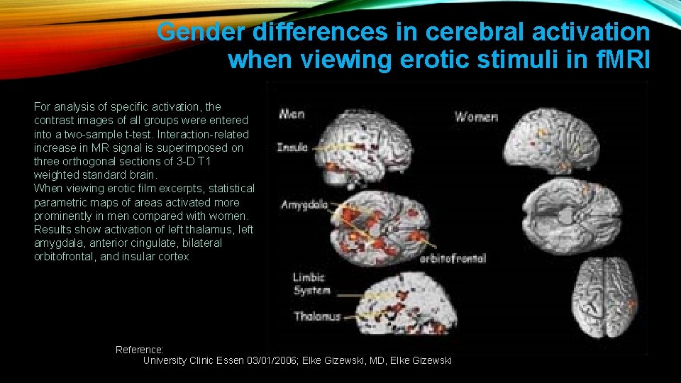 Gender differences in cerebral activation when viewing erotic stimuli in f. MRI For analysis