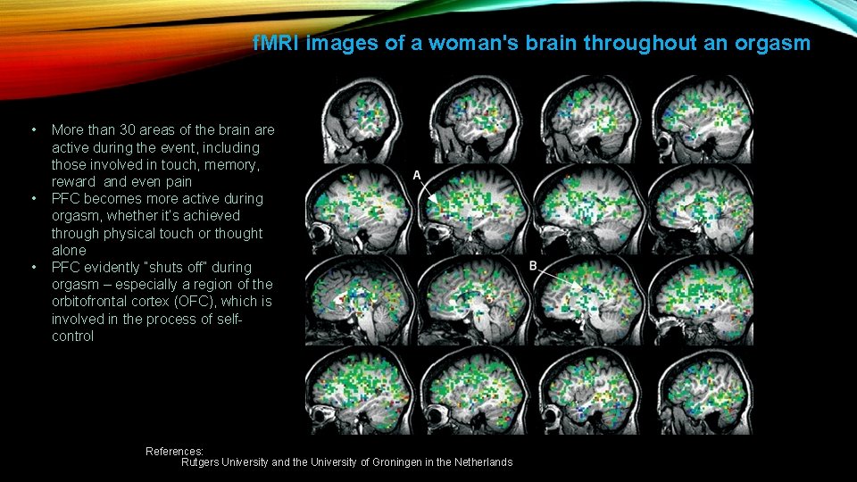f. MRI images of a woman's brain throughout an orgasm • • • More