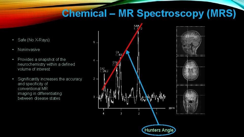 Chemical – MR Spectroscopy (MRS) • Safe (No X-Rays) • Noninvasive • Provides a