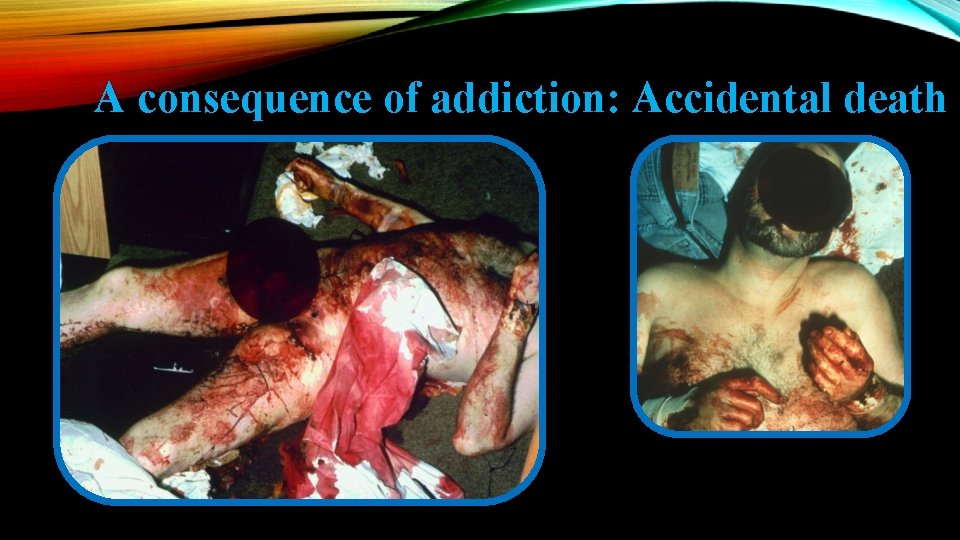 A consequence of addiction: Accidental death 