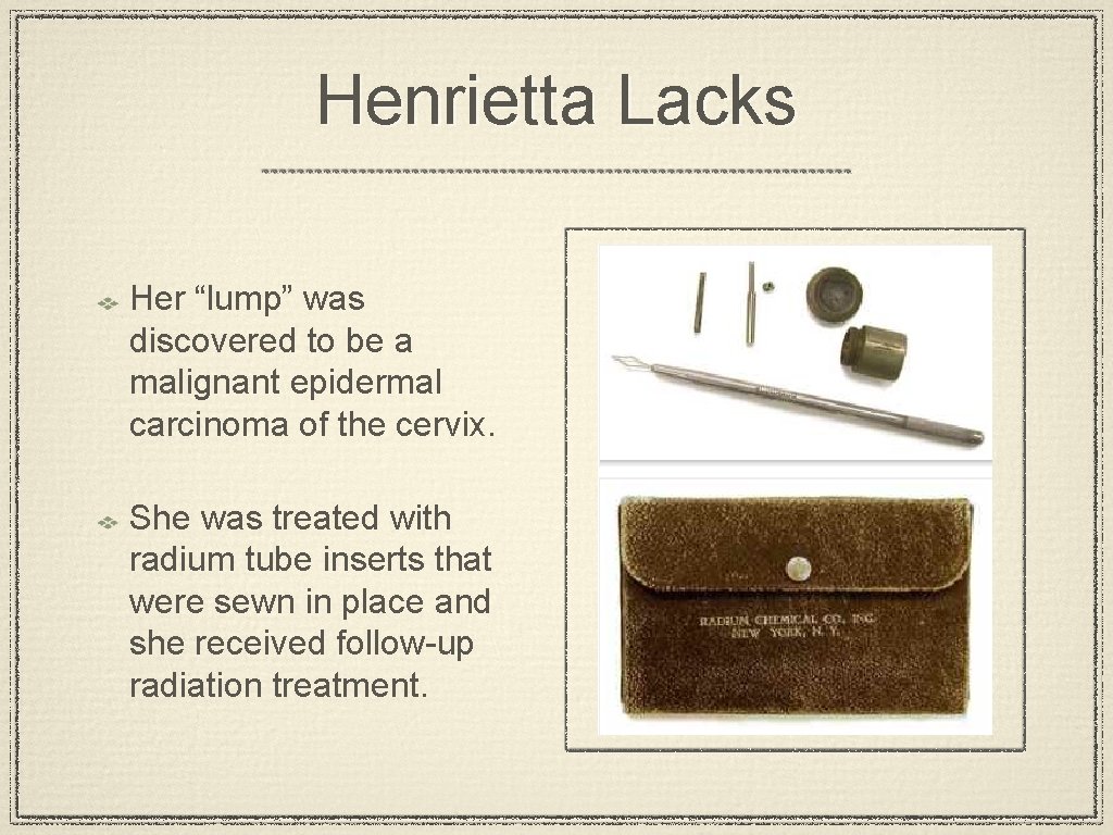 Henrietta Lacks Her “lump” was discovered to be a malignant epidermal carcinoma of the