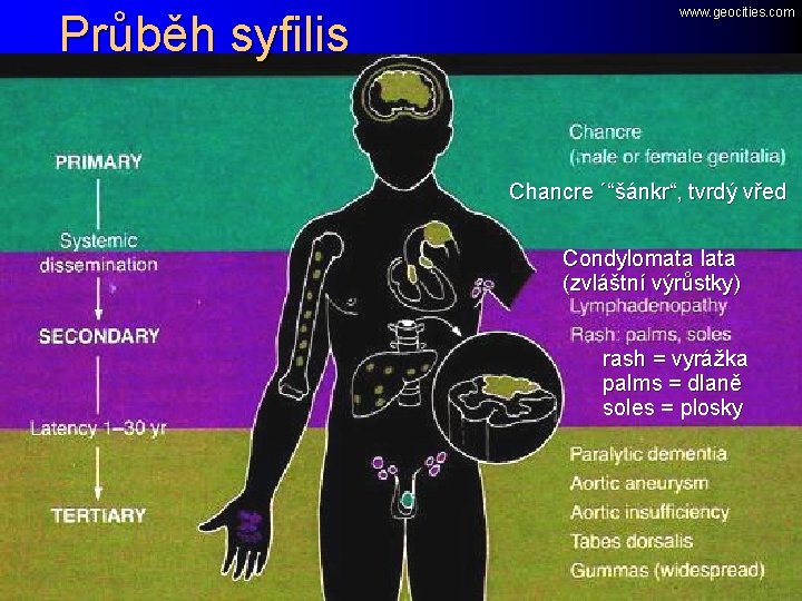 Průběh syfilis www. geocities. com Chancre ´“šánkr“, tvrdý vřed Condylomata lata (zvláštní výrůstky) rash