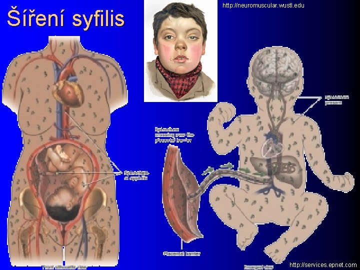 Šíření syfilis http: //neuromuscular. wustl. edu http: //services. epnet. com 