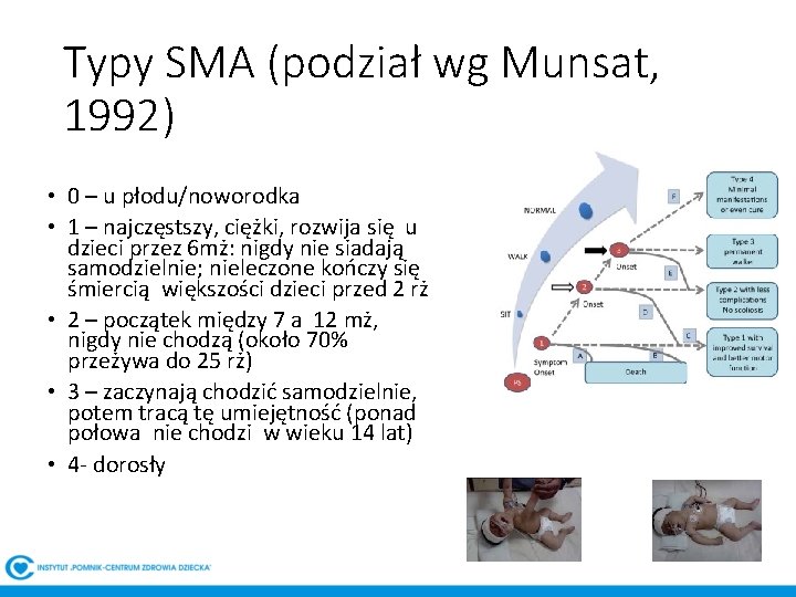 Typy SMA (podział wg Munsat, 1992) • 0 – u płodu/noworodka • 1 –