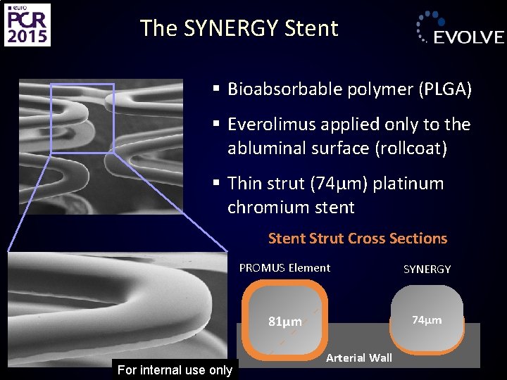 The SYNERGY Stent § Bioabsorbable polymer (PLGA) § Everolimus applied only to the abluminal