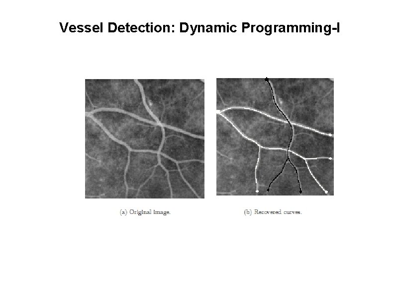 Vessel Detection: Dynamic Programming-I 