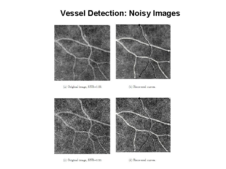 Vessel Detection: Noisy Images 