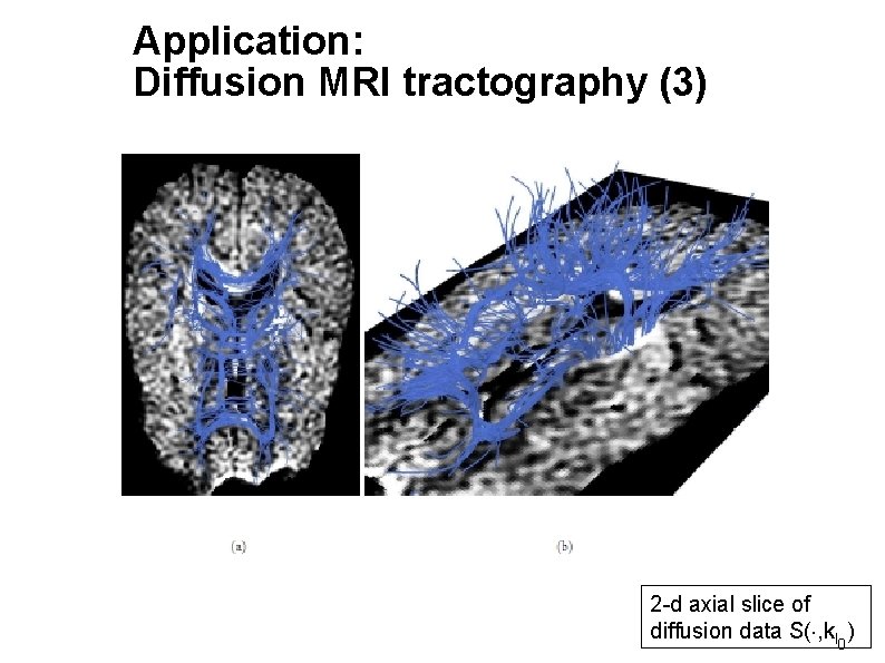 Application: Diffusion MRI tractography (3) 2 -d axial slice of diffusion data S( ,