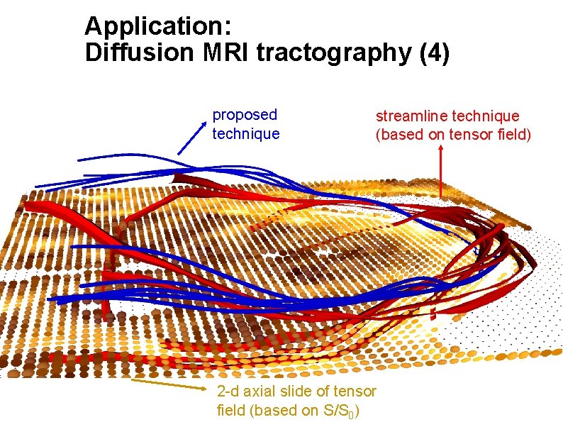 Application: Diffusion MRI tractography (4) proposed technique streamline technique (based on tensor field) 2