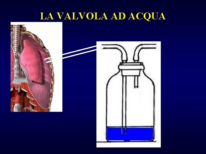 LA VALVOLA AD ACQUA 