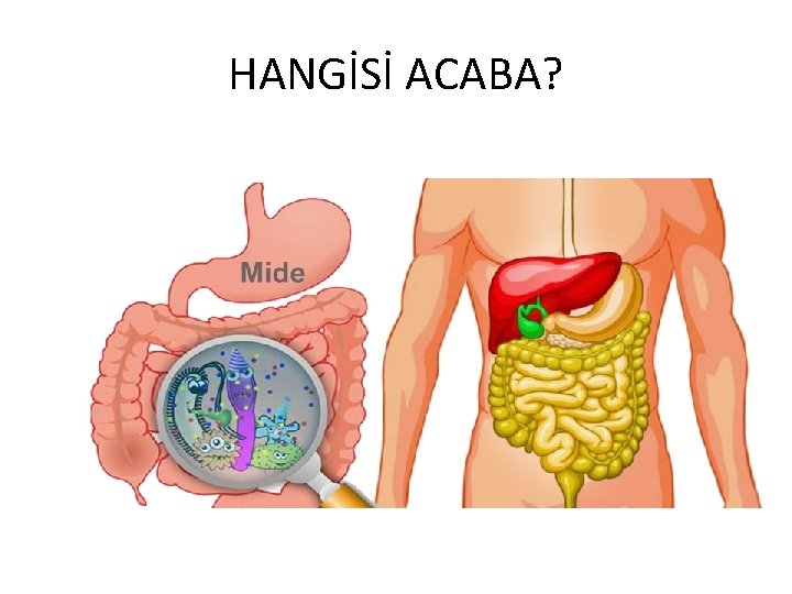 HANGİSİ ACABA? 