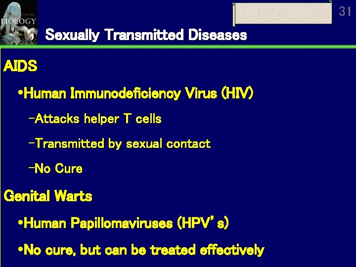 31 Sexually Transmitted Diseases AIDS Human Immunodeficiency Virus (HIV) Attacks helper T cells Transmitted