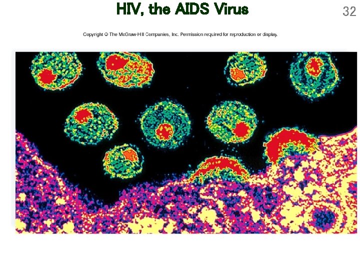 HIV, the AIDS Virus 32 