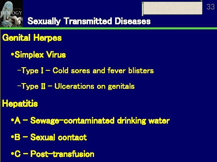 33 Sexually Transmitted Diseases Genital Herpes Simplex Virus Type I - Cold sores and