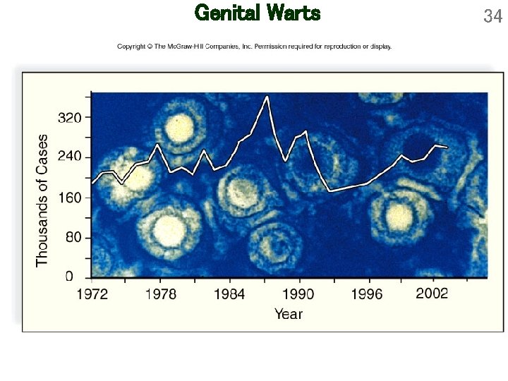 Genital Warts 34 