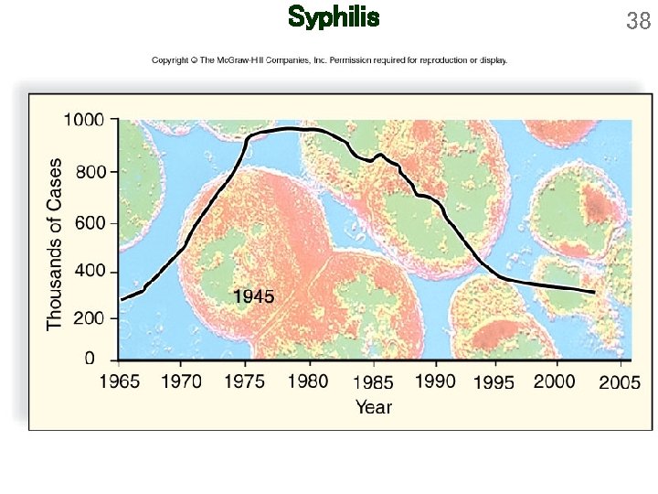 Syphilis 38 