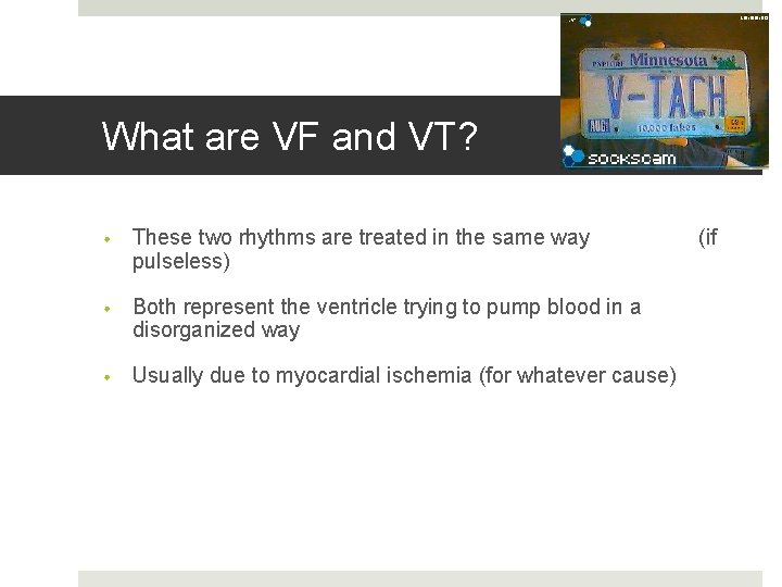 What are VF and VT? • These two rhythms are treated in the same