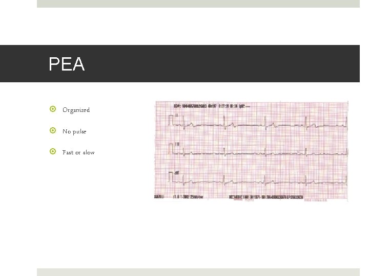 PEA Organized No pulse Fast or slow 
