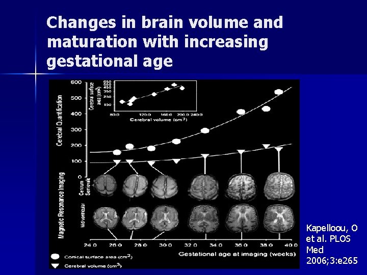 Changes in brain volume and maturation with increasing gestational age Kapelloou, O et al.