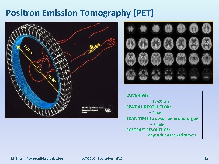 Positron Emission Tomography (PET) V ke 1 51 COVERAGE: ~ 15 -20 cm SPATIAL