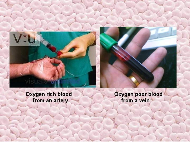 Oxygen rich blood from an artery Oxygen poor blood from a vein Oxygen rich blood from an artery Oxygen poor blood from a vein