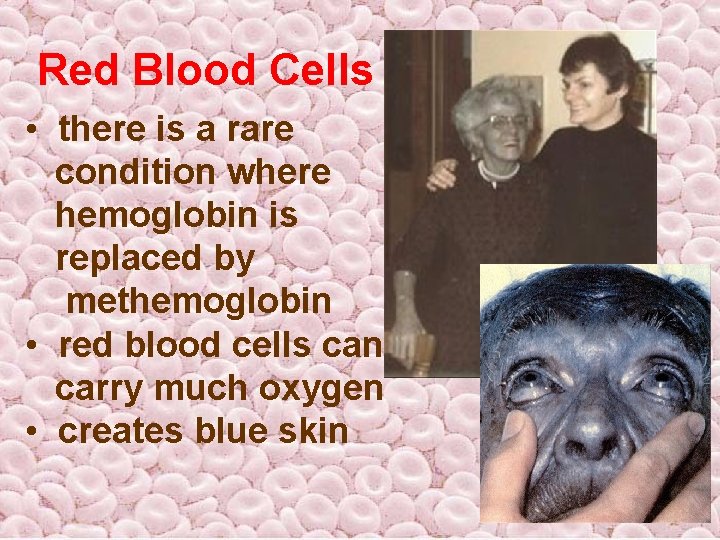 Red Blood Cells • there is a rare condition where hemoglobin is replaced by Red Blood Cells • there is a rare condition where hemoglobin is replaced by