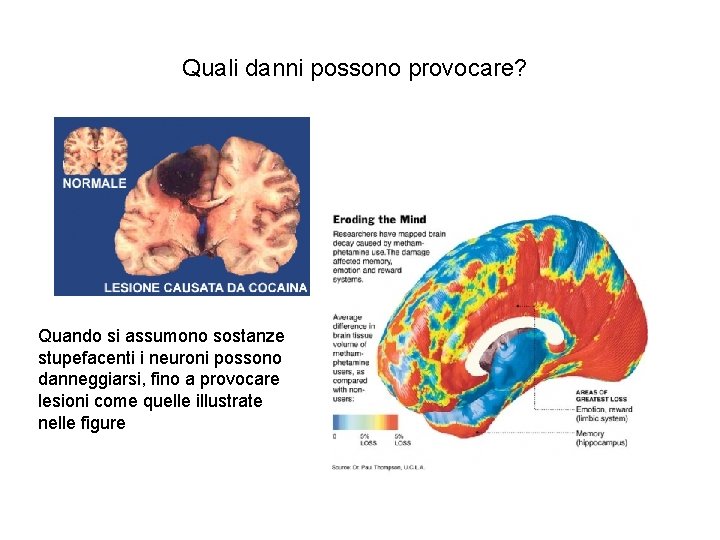 Quali danni possono provocare? Quando si assumono sostanze stupefacenti i neuroni possono danneggiarsi, fino