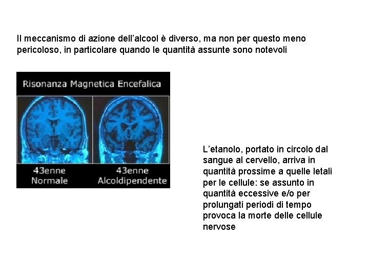 Il meccanismo di azione dell’alcool è diverso, ma non per questo meno pericoloso, in