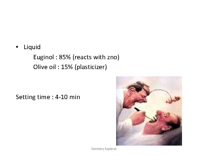  • Liquid Euginol : 85% (reacts with zno) Olive oil : 15% (plasticizer)