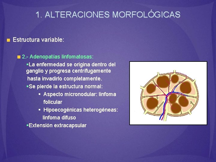 1. ALTERACIONES MORFOLÓGICAS Estructura variable: 2. - Adenopatías linfomatosas: §La enfermedad se origina dentro