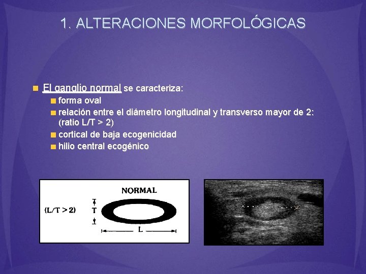 1. ALTERACIONES MORFOLÓGICAS El ganglio normal se caracteriza: forma oval relación entre el diámetro